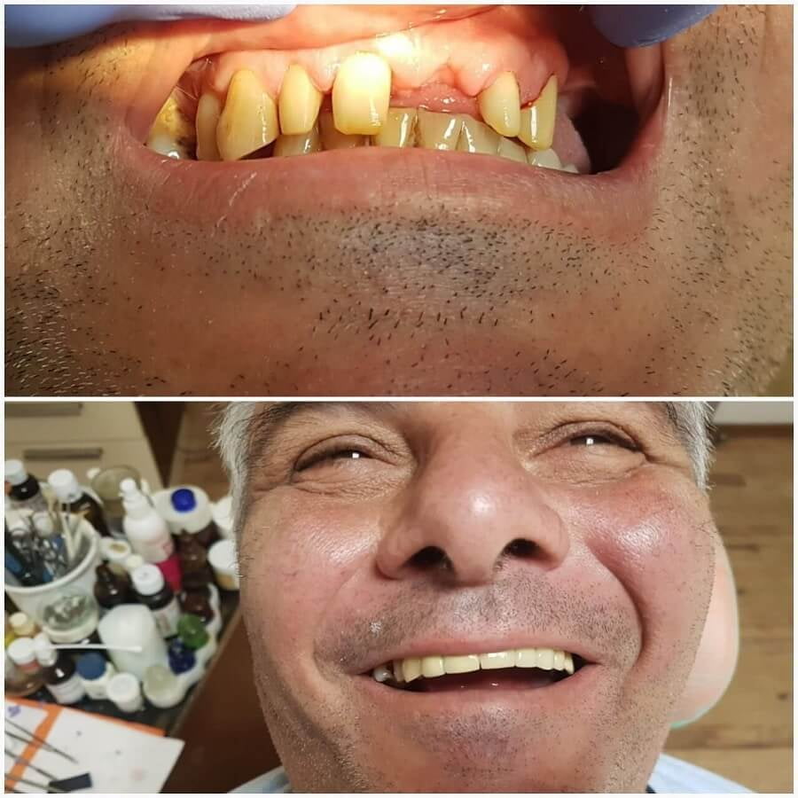 д-р Пламен Панайотов - зъболекар в град Ямбол преди - след